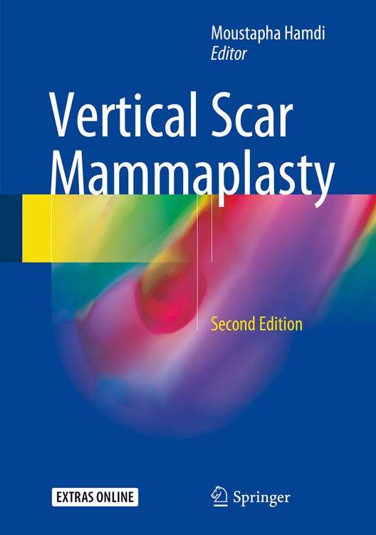 Produktbild: Vertical Scar Mammaplasty