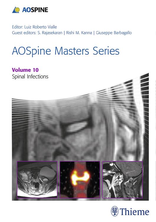 Produktbild: AOSpine Masters Series, Volume 10: Spinal Infections
