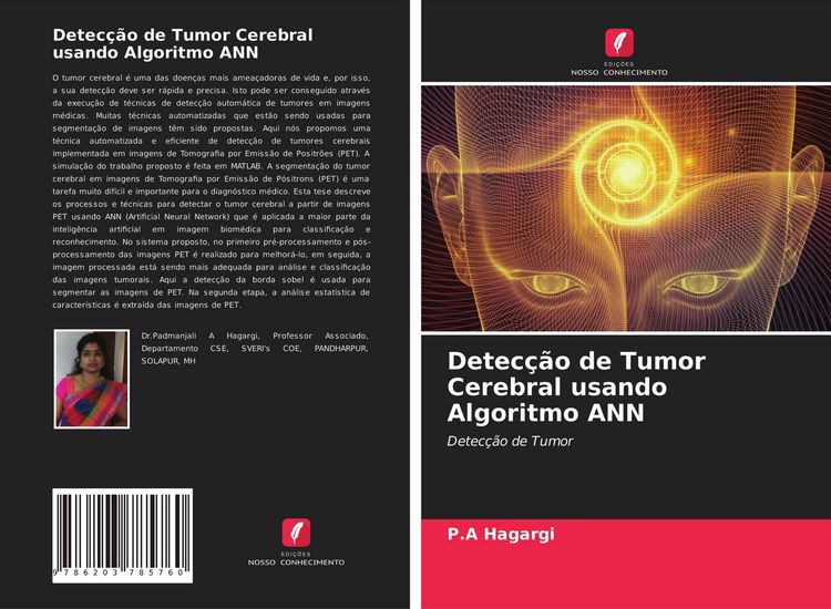 Produktbild: Detec&ccedil;&atilde;o de Tumor Cerebral usando Algoritmo ANN