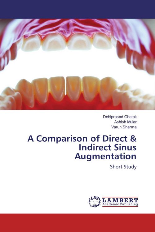 Produktbild: A Comparison of Direct & Indirect Sinus Augmentation
