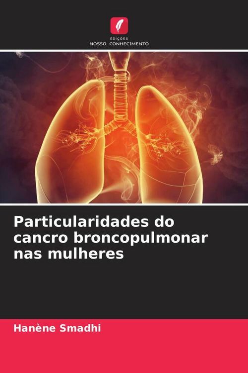 Produktbild: Particularidades do cancro broncopulmonar nas mulheres