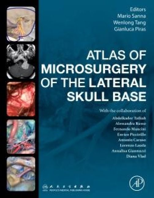 Produktbild: Atlas of Microsurgery of the Lateral Skull Base