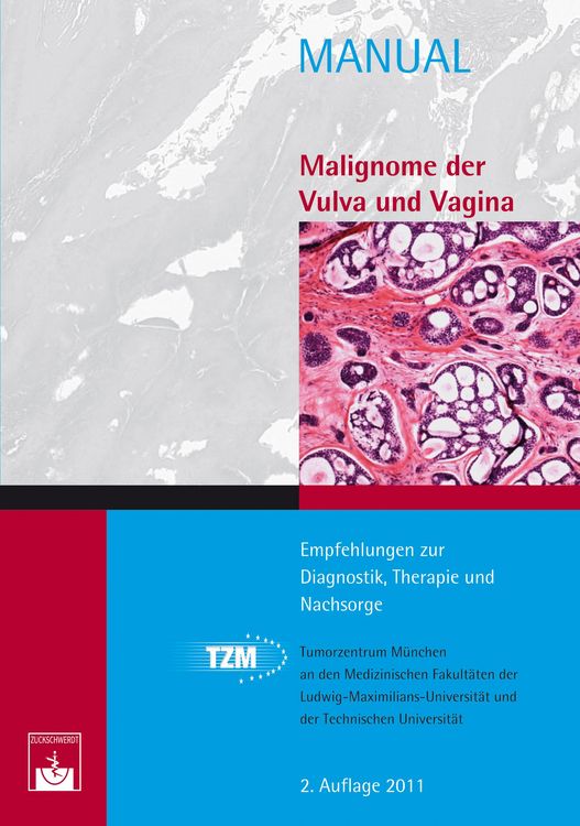 Produktbild: Malignome der Vulva und Vagina