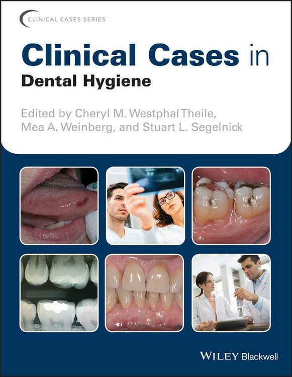 Produktbild: Clinical Cases in Dental Hygiene