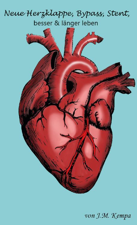 Produktbild: Neue Herzklappe, Bypass, Stent