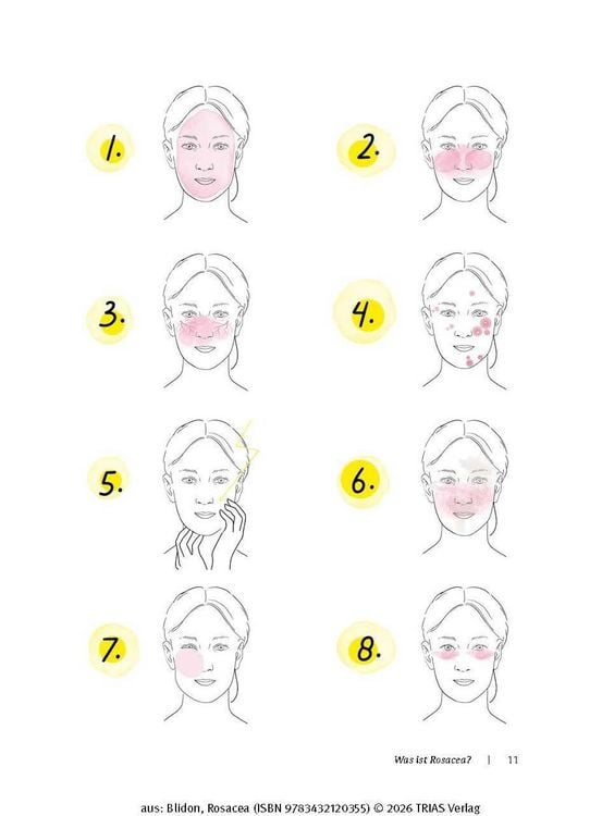 Produktbild: Rosacea