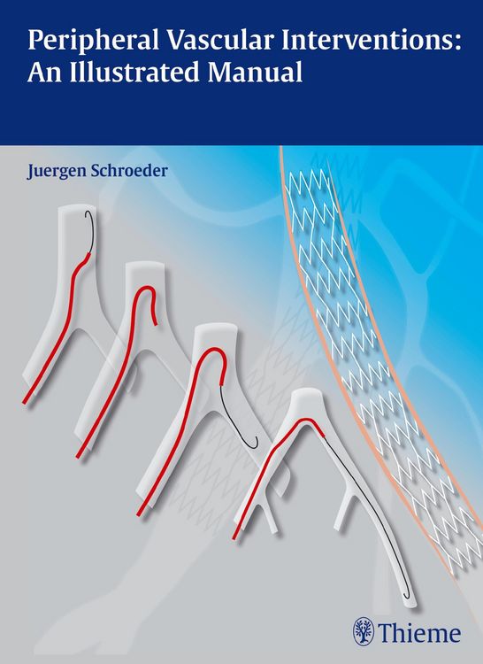 Produktbild: Peripheral Vascular Interventions: An Illustrated Manual