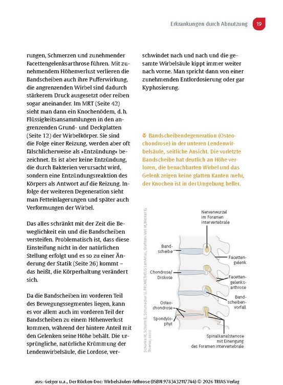 Produktbild: Der R&uuml;cken-Doc: Wirbels&auml;ulen-Arthrose