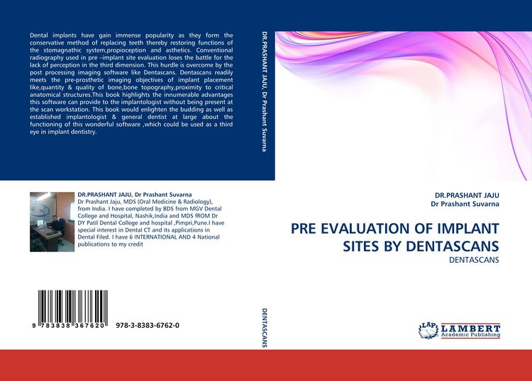Produktbild: Pre Evaluation Of Implant Sites By Dentascans