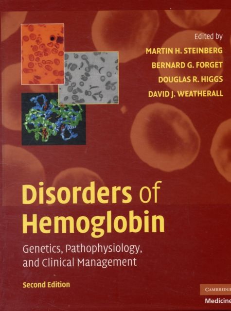 Produktbild: Disorders of Hemoglobin