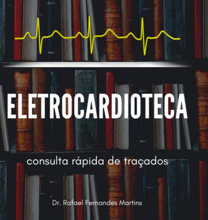 Produktbild: Eletrocardioteca