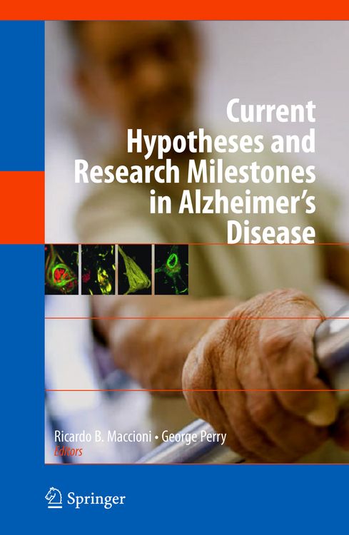 Produktbild: Current Hypotheses and Research Milestones in Alzheimer's Disease