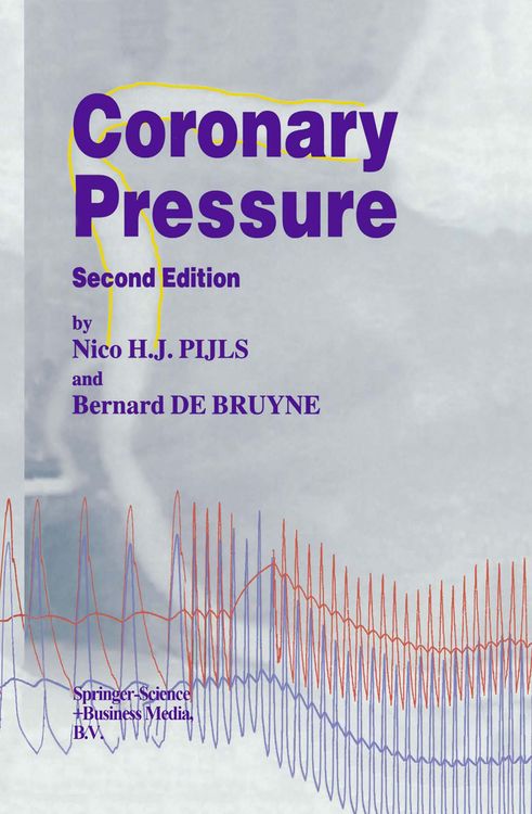 Produktbild: Coronary Pressure