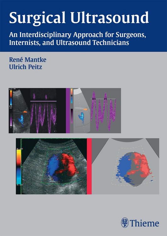 Produktbild: Surgical Ultrasound