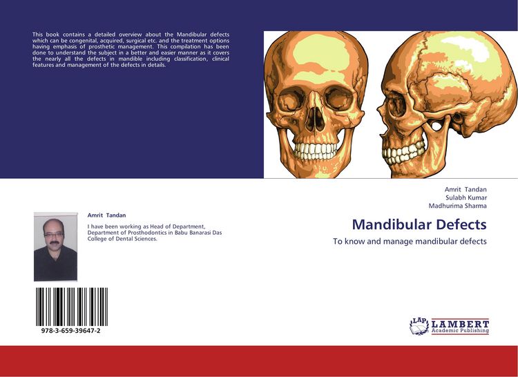 Produktbild: Mandibular Defects