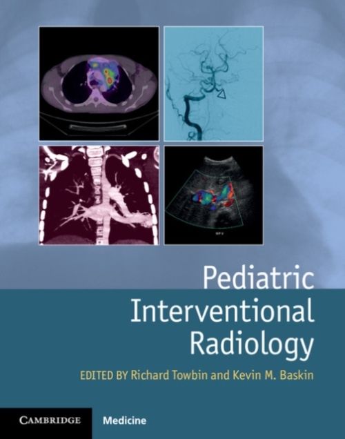 Produktbild: Pediatric Interventional Radiology