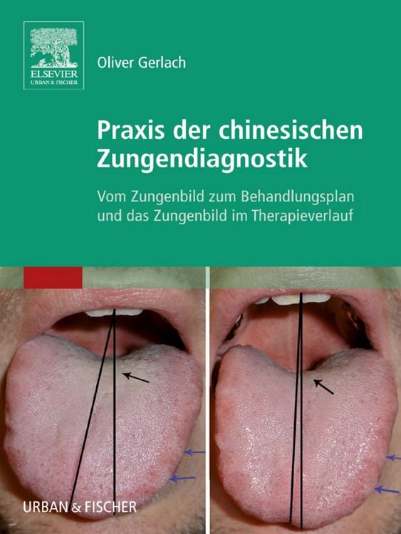 Produktbild: Praxis der chinesischen Zungendiagnostik