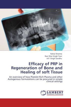 Produktbild: Sharma, R: Efficacy of PRP in Regeneration of Bone and Heali