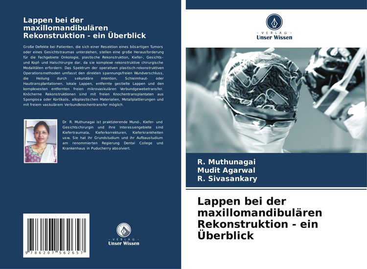 Produktbild: Lappen bei der maxillomandibul&auml;ren Rekonstruktion - ein &Uuml;berblick