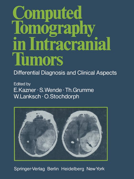 Produktbild: Computed Tomography in Intracranial Tumors