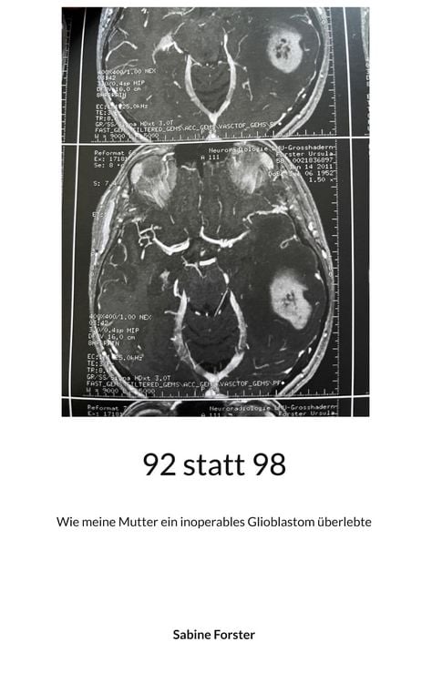 Produktbild: 92 statt 98