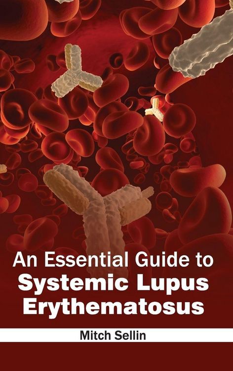 Produktbild: An Essential Guide to Systemic Lupus Erythematosus