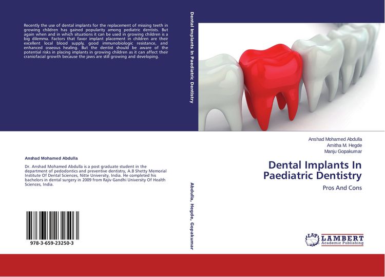 Produktbild: Dental Implants In Paediatric Dentistry