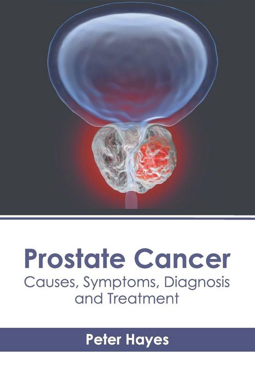 Produktbild: Prostate Cancer: Causes, Symptoms, Diagnosis and Treatment