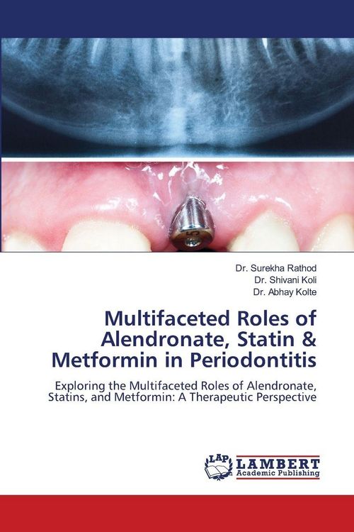 Produktbild: Multifaceted Roles of Alendronate, Statin & Metformin in Periodontitis