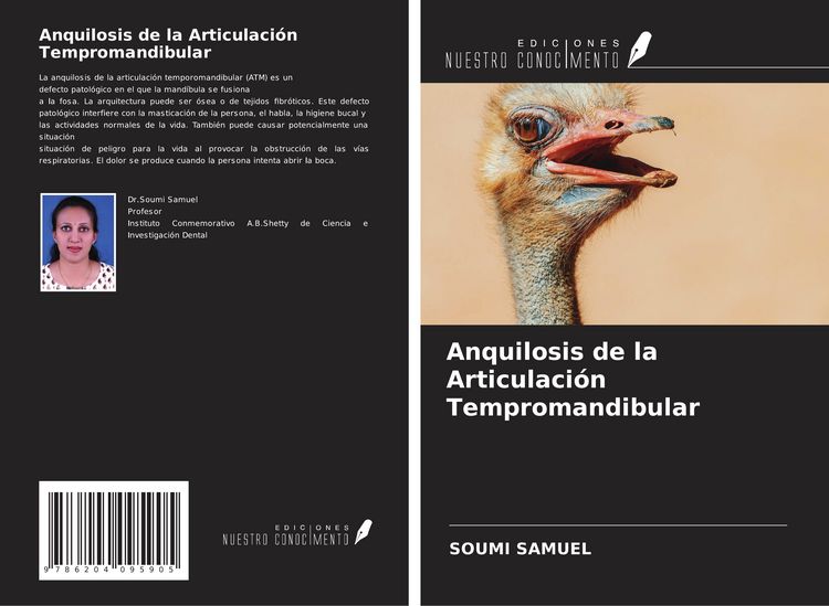 Produktbild: Anquilosis de la Articulaci&oacute;n Tempromandibular