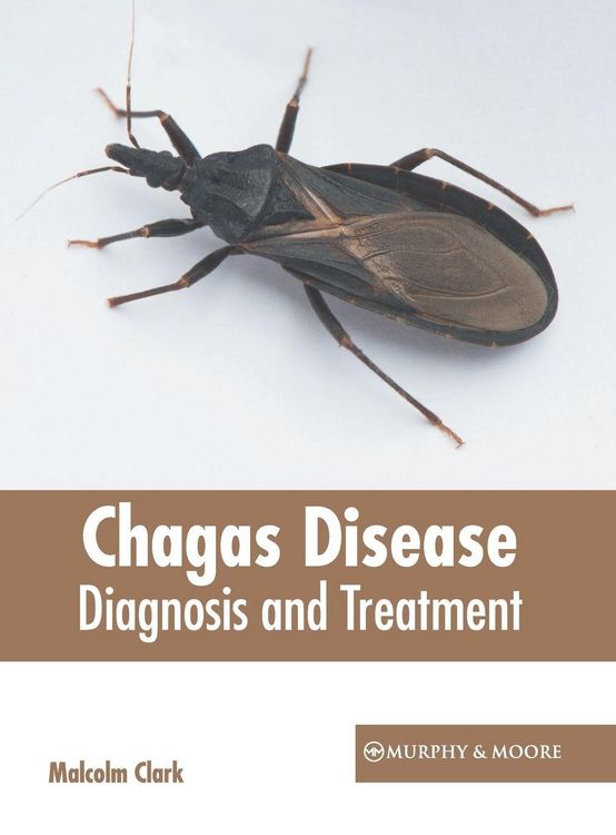 Produktbild: Chagas Disease: Diagnosis and Treatment