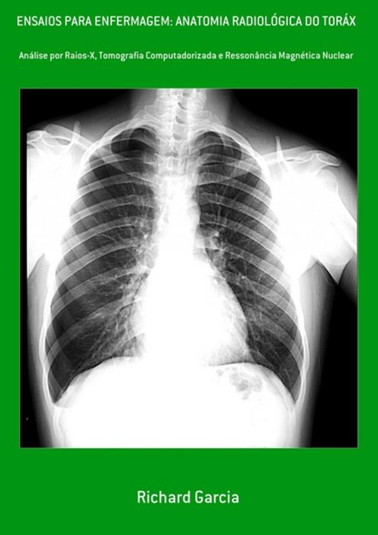 Produktbild: Ensaios Para Enfermagem: Anatomia Radiol&oacute;gica Do Tor&aacute;x
