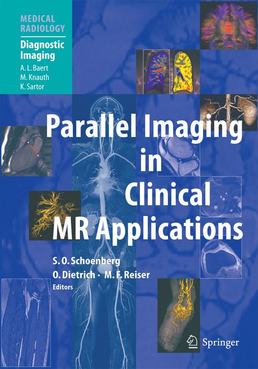 Produktbild: Parallel Imaging in Clinical MR Applications
