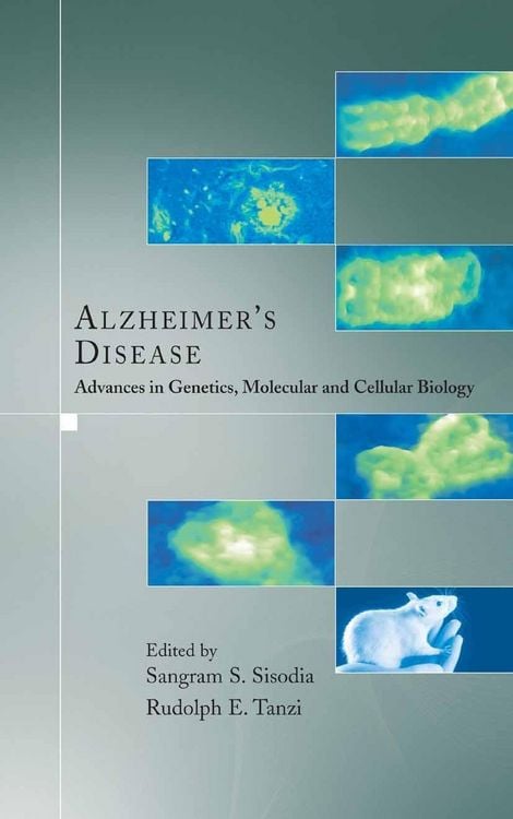 Produktbild: Alzheimer's Disease