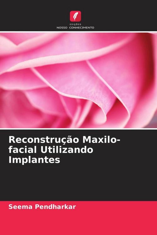 Produktbild: Reconstru&ccedil;&atilde;o Maxilo-facial Utilizando Implantes