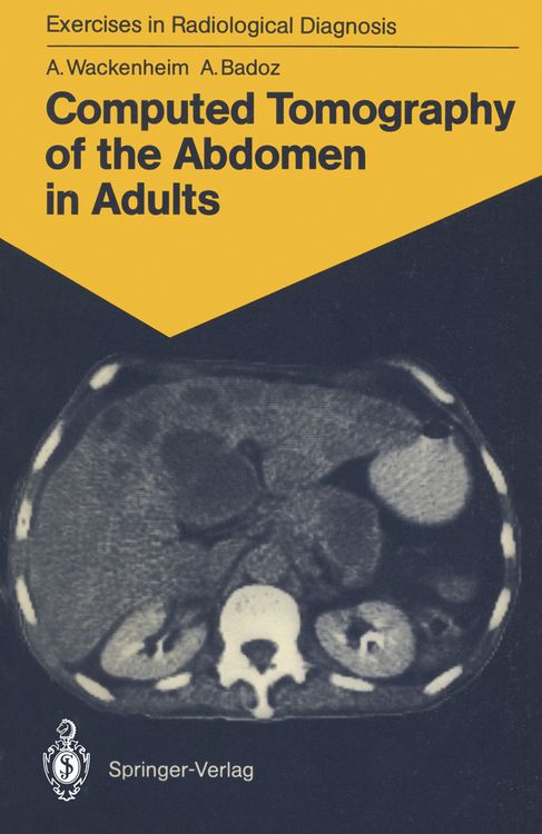 Produktbild: Computed Tomography of the Abdomen in Adults