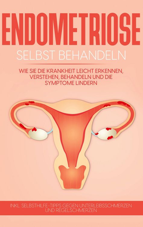 Produktbild: Endometriose selbst behandeln: Wie Sie die Krankheit leicht erkennen, verstehen, behandeln und die Symptome lindern - inkl. Selbsthilfe-Tipps gegen Un