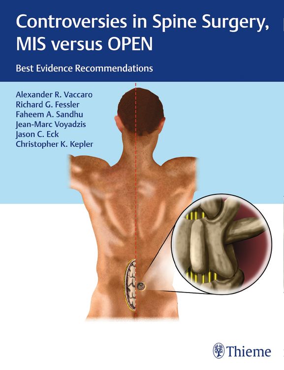 Produktbild: Controversies in Spine Surgery, MIS versus OPEN