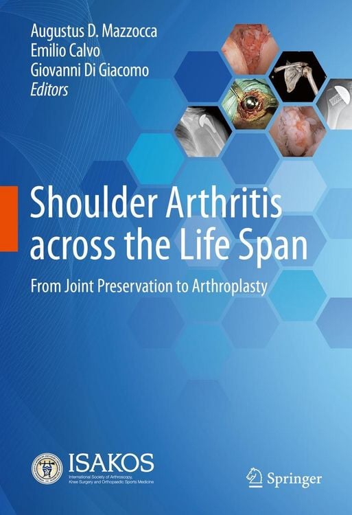 Produktbild: Shoulder Arthritis across the Life Span