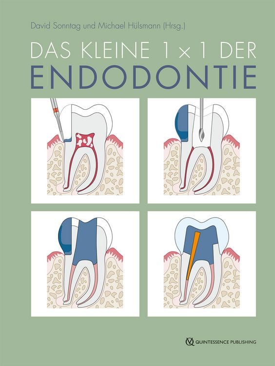 Produktbild: Das kleine 1x1 der Endodontie
