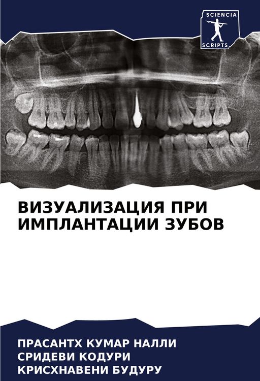 Produktbild: Vizualizaciya Pri Implantacii Zubov