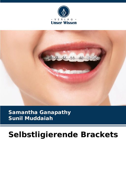 Produktbild: Selbstligierende Brackets