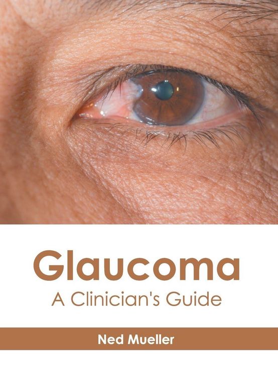 Produktbild: Glaucoma: A Clinician's Guide