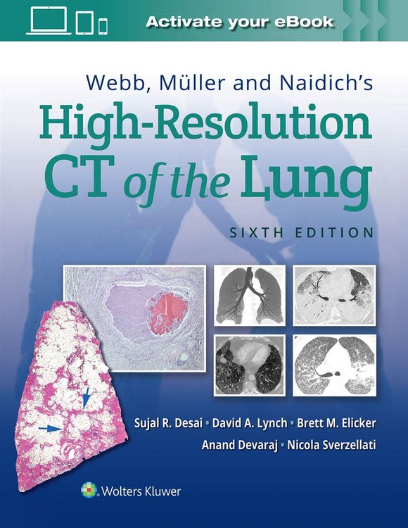 Produktbild: Webb, Muller and Naidich's High Resolution of Lung CT