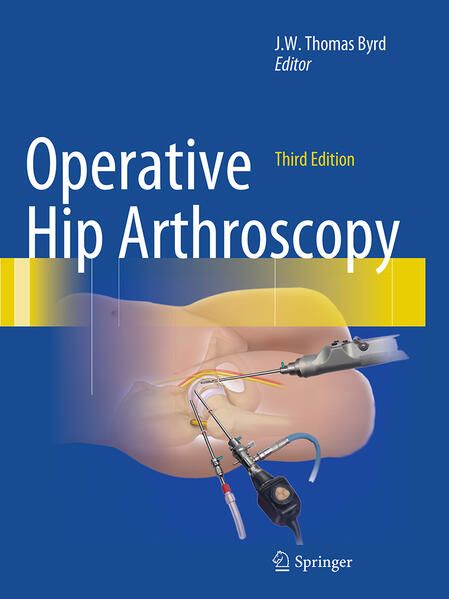 Produktbild: Operative Hip Arthroscopy