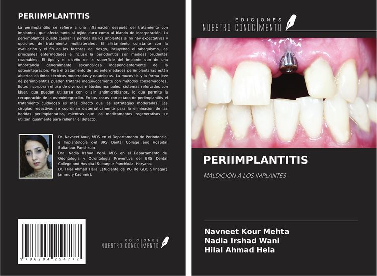 Produktbild: Periimplantitis