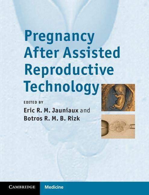Produktbild: Pregnancy After Assisted Reproductive Technology