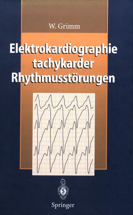 Produktbild: Elektrokardiographie tachykarder Rhythmusst&ouml;rungen