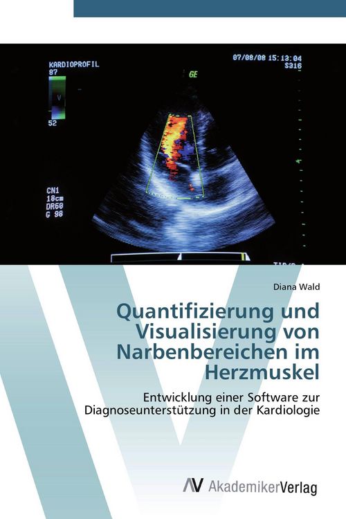 Produktbild: Quantifizierung und Visualisierung von Narbenbereichen im Herzmuskel
