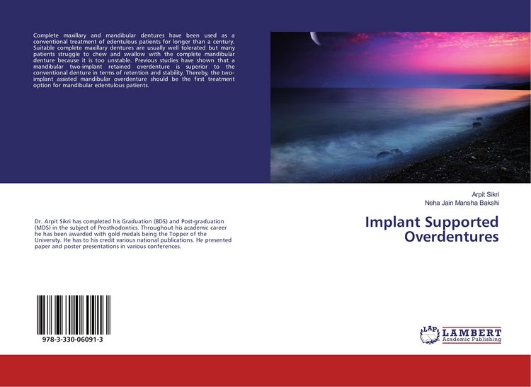 Produktbild: Implant Supported Overdentures